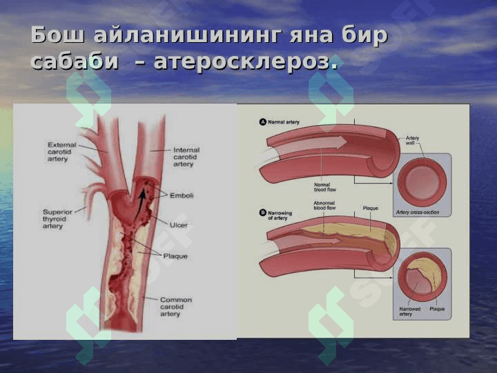 PSEVDONEVROLOGIK SINDROMLAR TURLARI 8