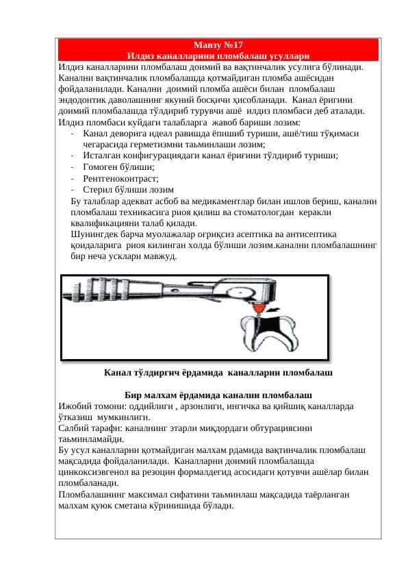 Илдиз каналларини пломбалаш усуллари