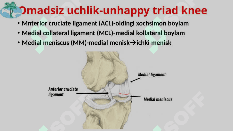 Tizza bo’g’imi shikastlanishlari 7