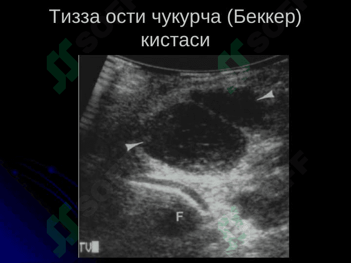 Таянч-харакат тизими касалликлари нур ташхиси 7