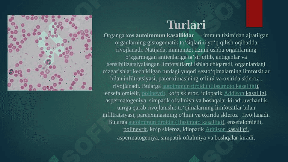 Autoimmun va allergik kasalliklar kelib chiqishi, kechishi diagnostikasi. 4
