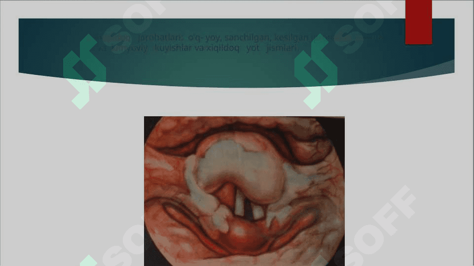 HIQILDOQNING O‘TKIR VA SURUNKALI KASALLIKLARI 5