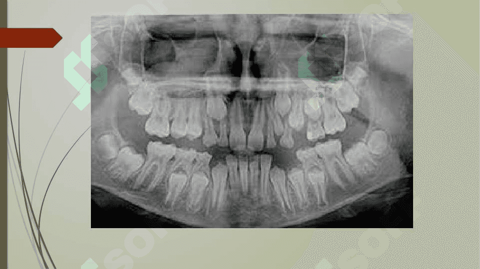 Odontoparodontogramma taxlili 4