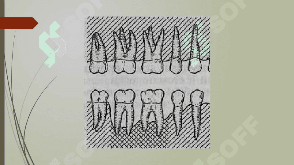 Odontoparodontogramma taxlili 8