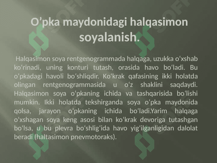 Halqasimon Soyalanish 2