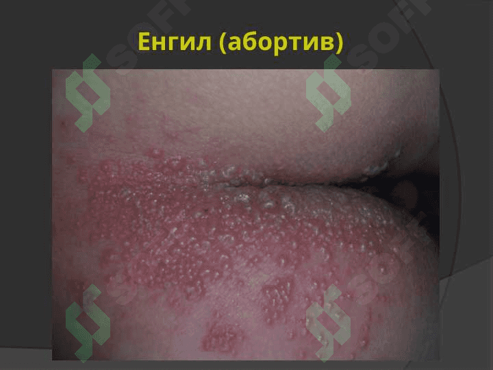 Ўраб олувчи темиратки 8