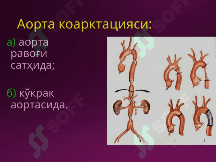 Laparotomiya turlari 5