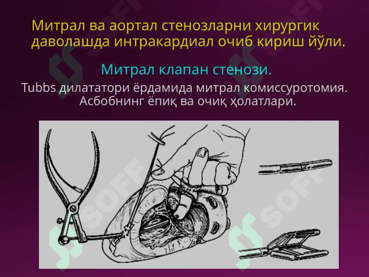 Laparotomiya turlari 6