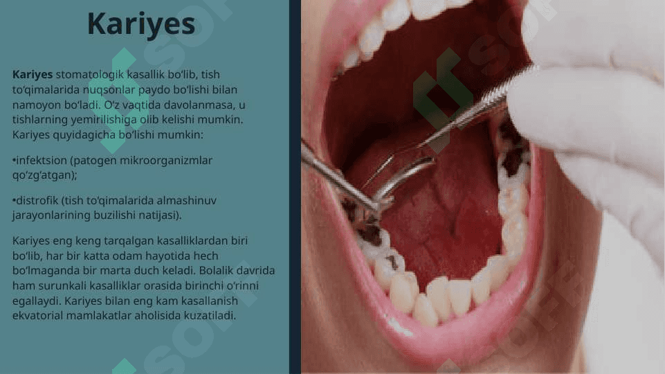 5-sinf karies kavakni charxlash tamoyili 2