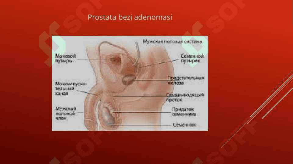 Prostata bezi adenomasi va uning yoshga bog’liq o’zgarishlari 6
