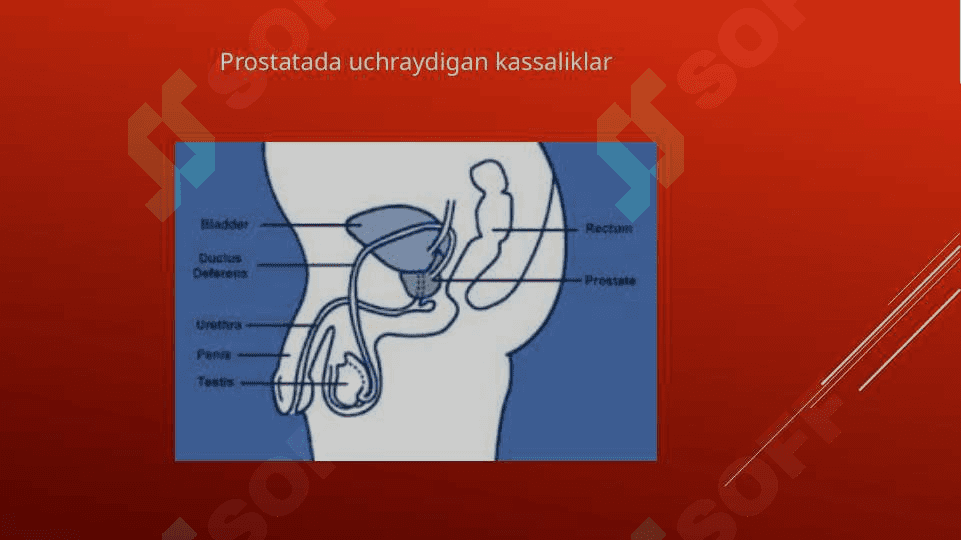 Prostata bezi adenomasi va uning yoshga bog’liq o’zgarishlari 7