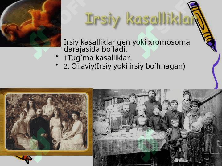 Tug`ma nuqson kasalliklari . Gen kasdalliklari 5