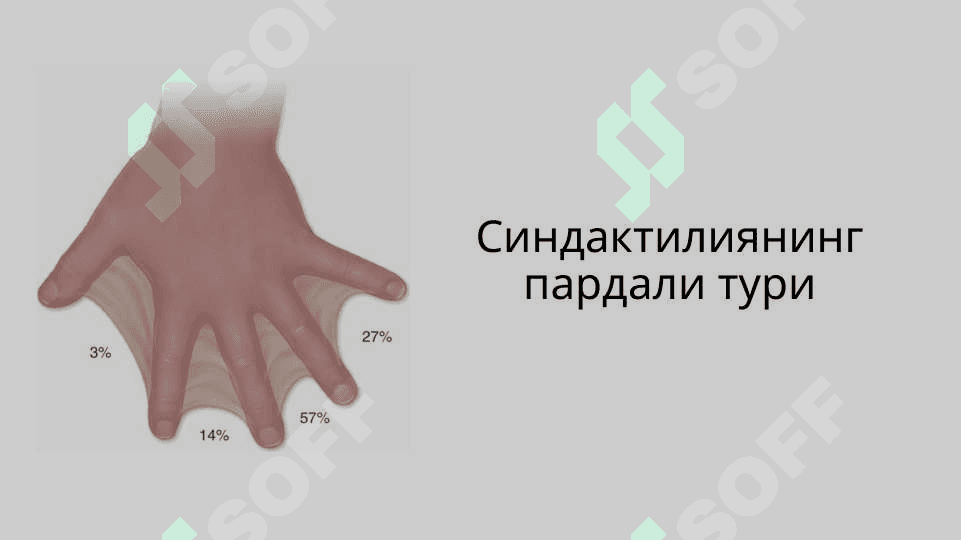 Qo`l va oyoq anomaliyalari . Қўл ва оёқ аномалиялари 8