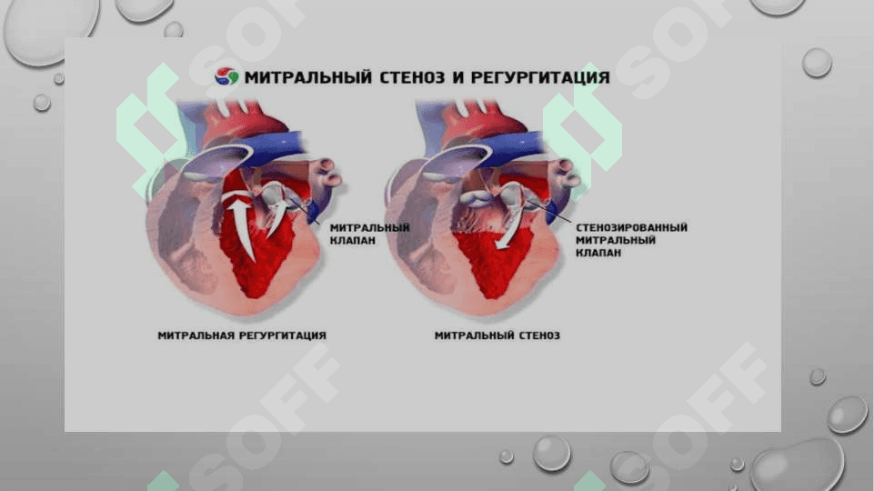 Revmatik isitma simptamotologiyasi . Mitral klapan nuqsonlari . Mitral klapan yetishmovchiligi va stenozi . Diagnostikasi . Davolash asosiy prinsiplari . Aortal klapan nuqsonlari simptomatologiyasi . Aortal klapan yetishmovchiligi va stenozi 8