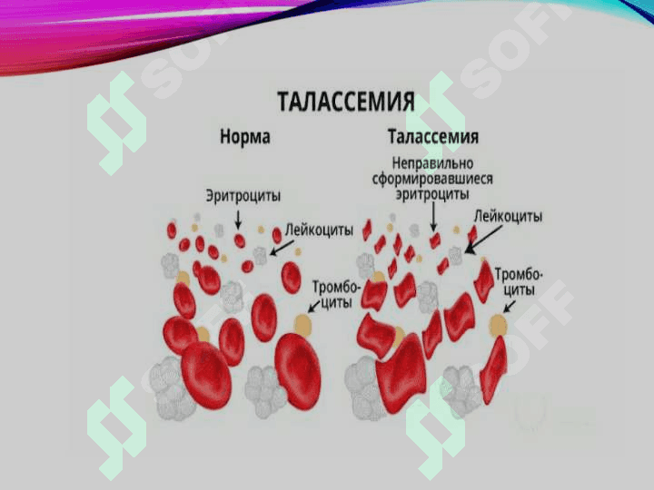 Talassemiya laborator diagnostikasi 8