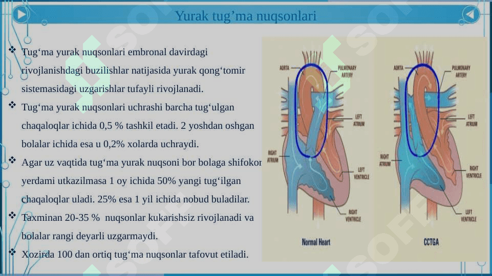 Yurak klapanlari kasalliklari. Revmatik kasalliklar. Kardiomiopatiyalar. 4