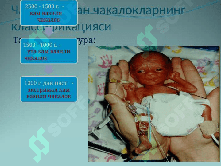 Chala tug`ilgan chaqaloqlar . Чала тугилган чакалоклар 4