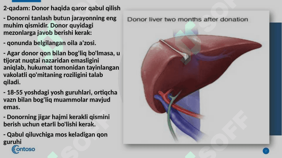 Jigar transplantatsiyasi. 7
