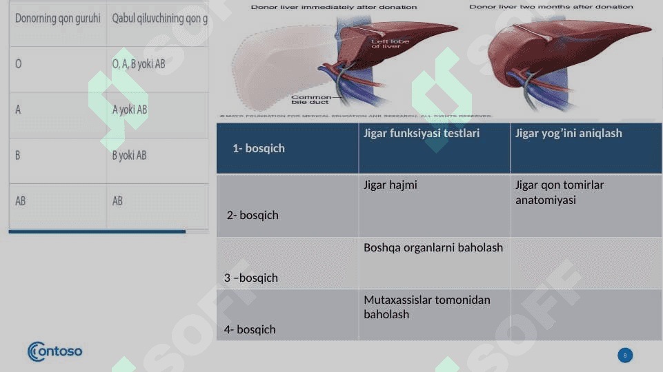 Jigar transplantatsiyasi. 8