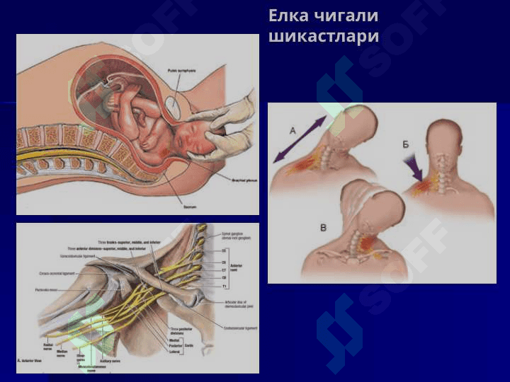 QO`L - OYOQ NERV POYALARINING JARROXLIK ANATOMIYASI VA PERIFERIK NERVLARDA OPERATSIYALAR 8