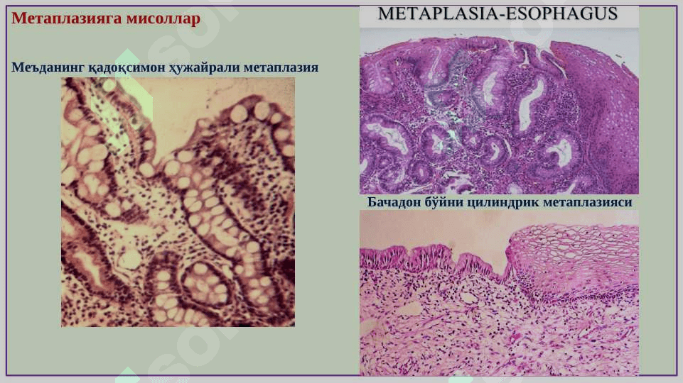 Patologiya faniga kirish. Hujayra patologiyasi, nekroz, hujayrada metabolitlar to’planishi 7