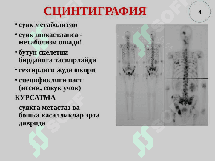 Tayanch-xarakat tizimi kasalliklarining nur tashxisi 4