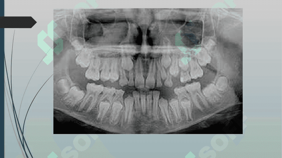 ODONTOPARODONTOGRAMMA TAHLILI. STOMATOLOGIYA 4
