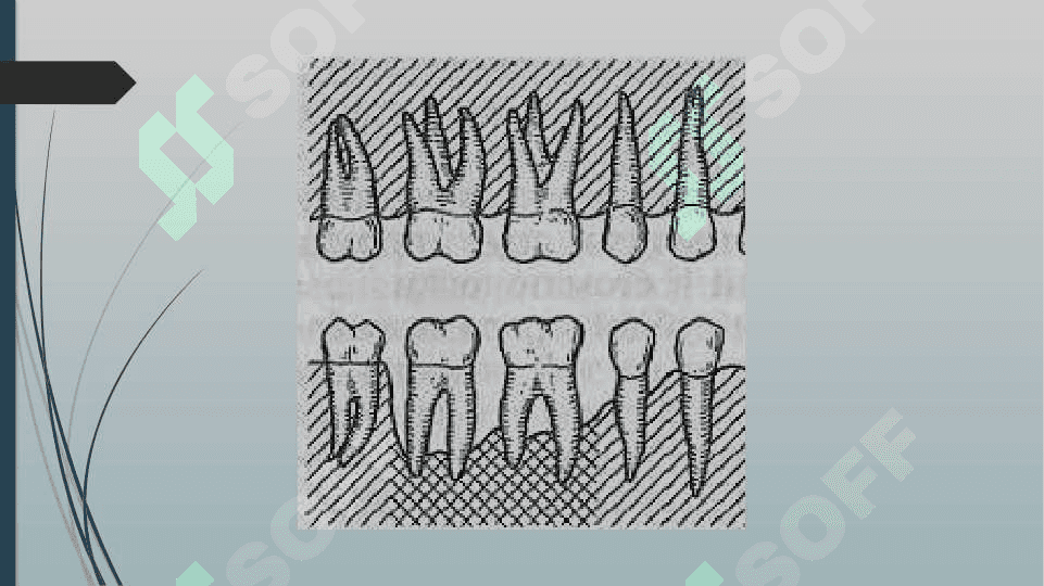 ODONTOPARODONTOGRAMMA TAHLILI. STOMATOLOGIYA 8