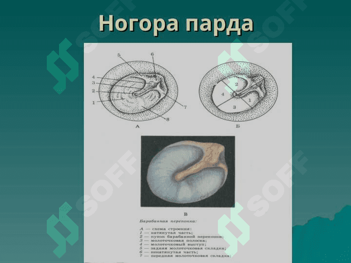 TASHQI VA O`RTA QULOQNING O`TKIR VA SURUNKALI KASALLIKLARI. 4