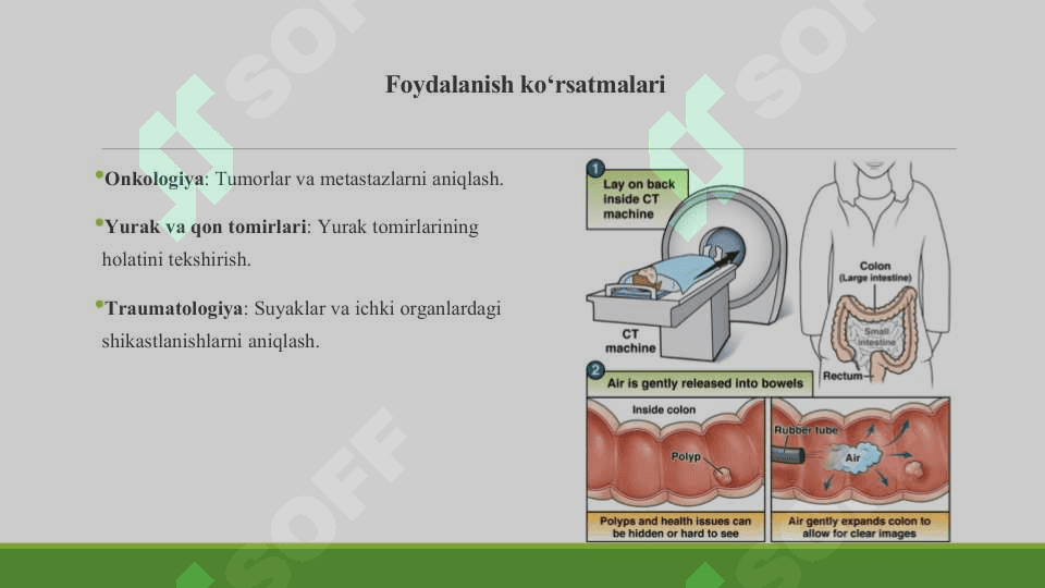 Radionukleid tekshiruv usullari haqida tushuncha (turlari,afzallik va kamchiliklari, fizikasi, qarshi ko'rsatma va ko'rsatmalar). Kompyuter tomogtrafiya misolida. 8