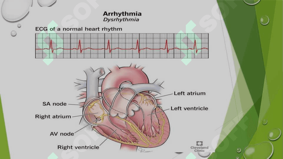 Yurak aritmiyalari EKG diagnostikasi 3