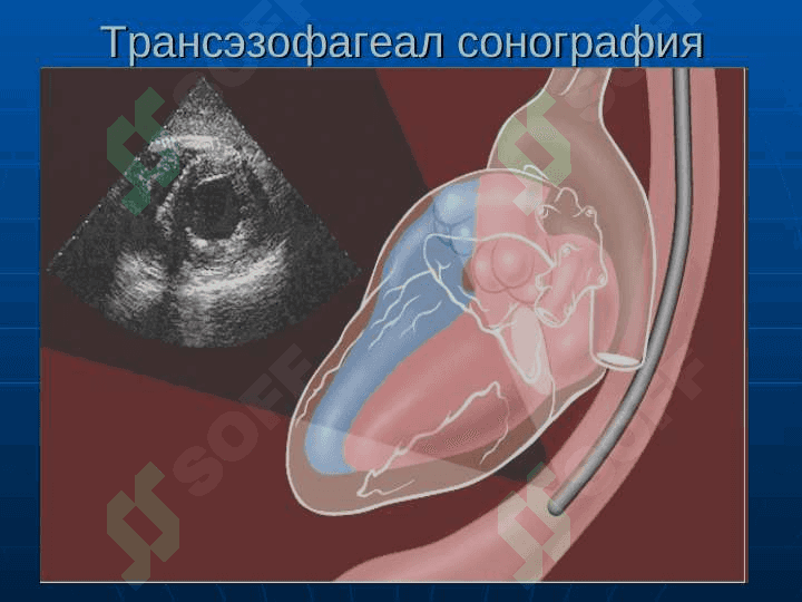 YURAK KASALLIKLARINI NUR TASHXISI 7