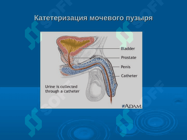 Эндоскопическая урология. 3