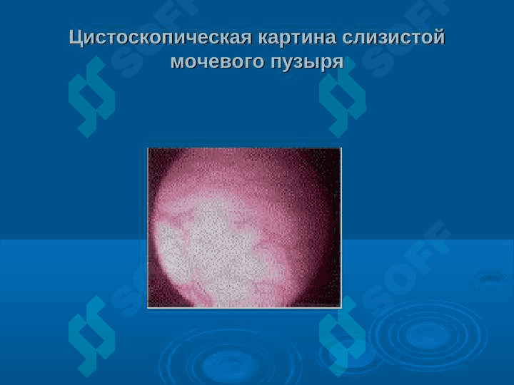 Эндоскопическая урология. 8