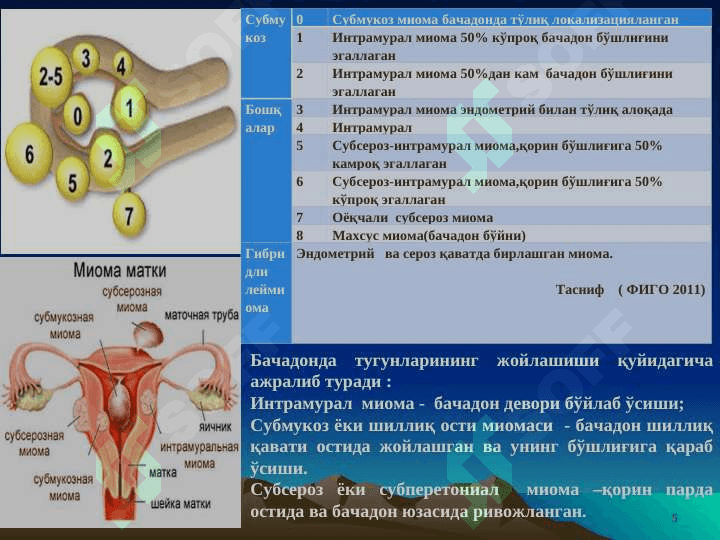 BACHADON MIOMASI 5