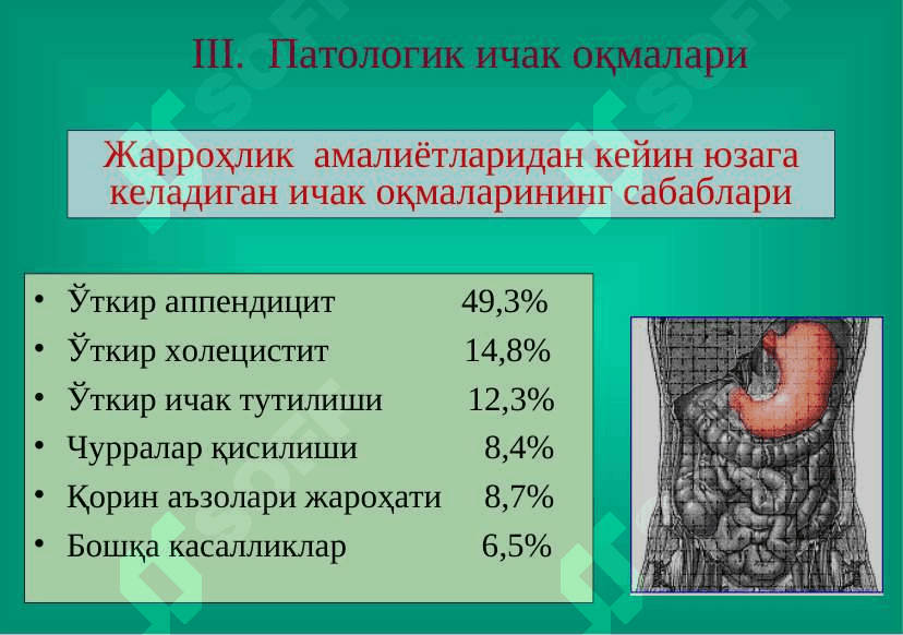 ICHAK OQMALARI 7