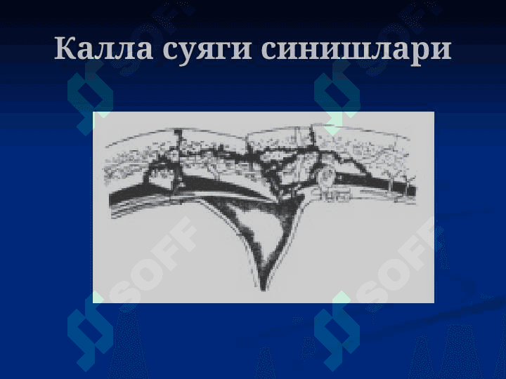 НЕЙРОХИРУРГИЯ 8