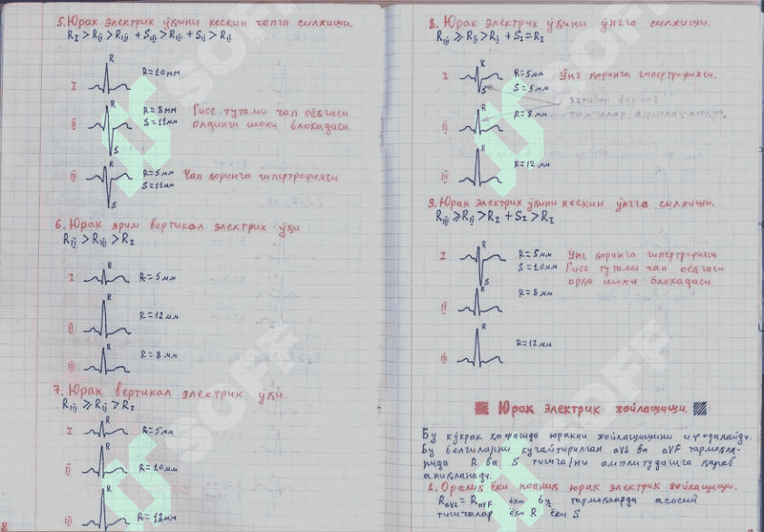 EKG haqida toliq malumot davolash usullari bilan 5