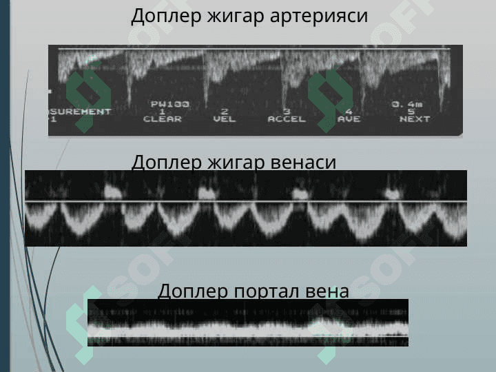 JIGAR KASALLIKLARI NUR TASHXISI. JIGAR KASALLIKLARI NUR DIAGNOSTIKA 4