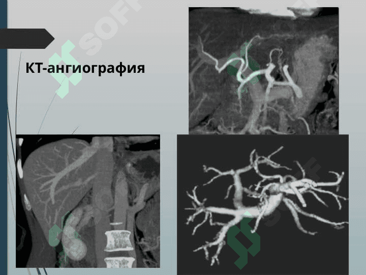 JIGAR KASALLIKLARI NUR TASHXISI. JIGAR KASALLIKLARI NUR DIAGNOSTIKA 7