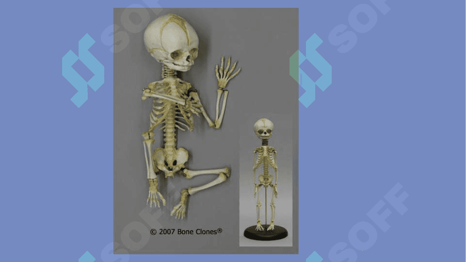 Bolalarda suyak tizimini anatomo – fiziologik hususiyatlari. Skeletni usishi va shakillanishi. Suyak usti pardasini hususiyatlari 4