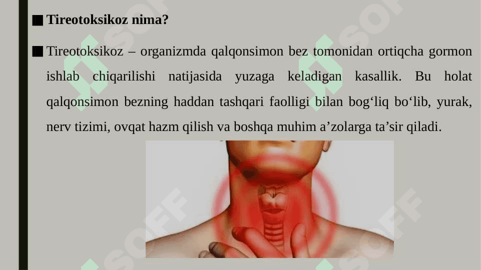 Tireotoksikoz 3