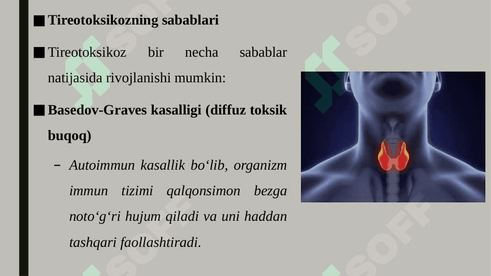 Tireotoksikoz 4