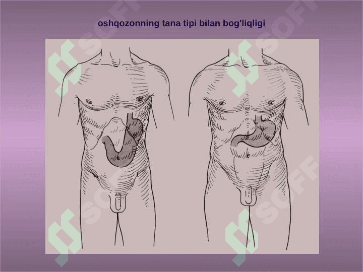 Oshqozonda bajariladigan operatsiyalar 8
