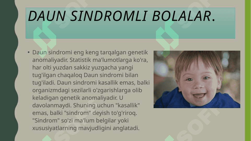 Daun sindromli bolalar 3