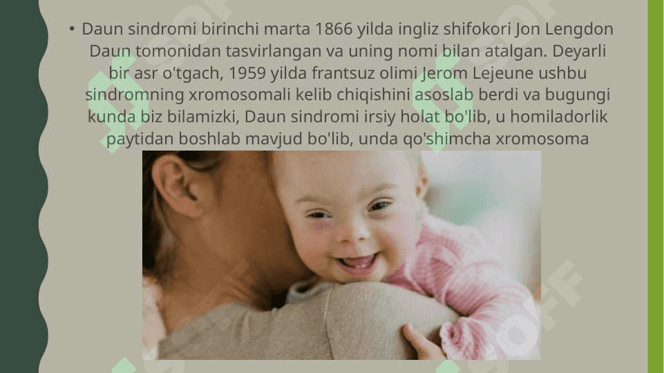 Daun sindromli bolalar 4