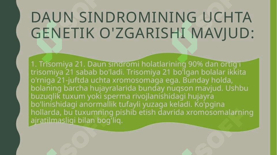 Daun sindromli bolalar 6