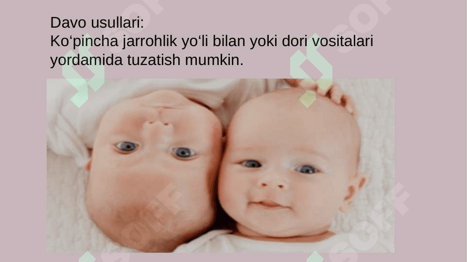 Bolalarda eshitish nuqsonining kelib chiqish sabablari va turlari 5