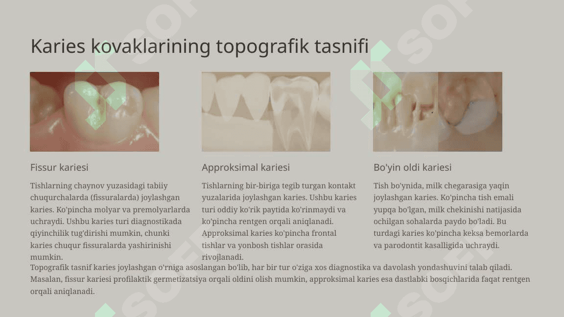 Karies haqida tushuncha. Karies kovaklarning tasnifi. 7