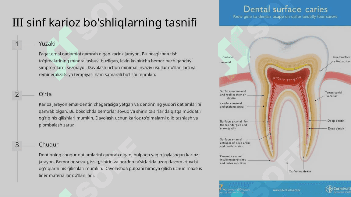 Fantomlarda III sinf karioz bo‘shliqlarini charxlash va plombalash. 3
